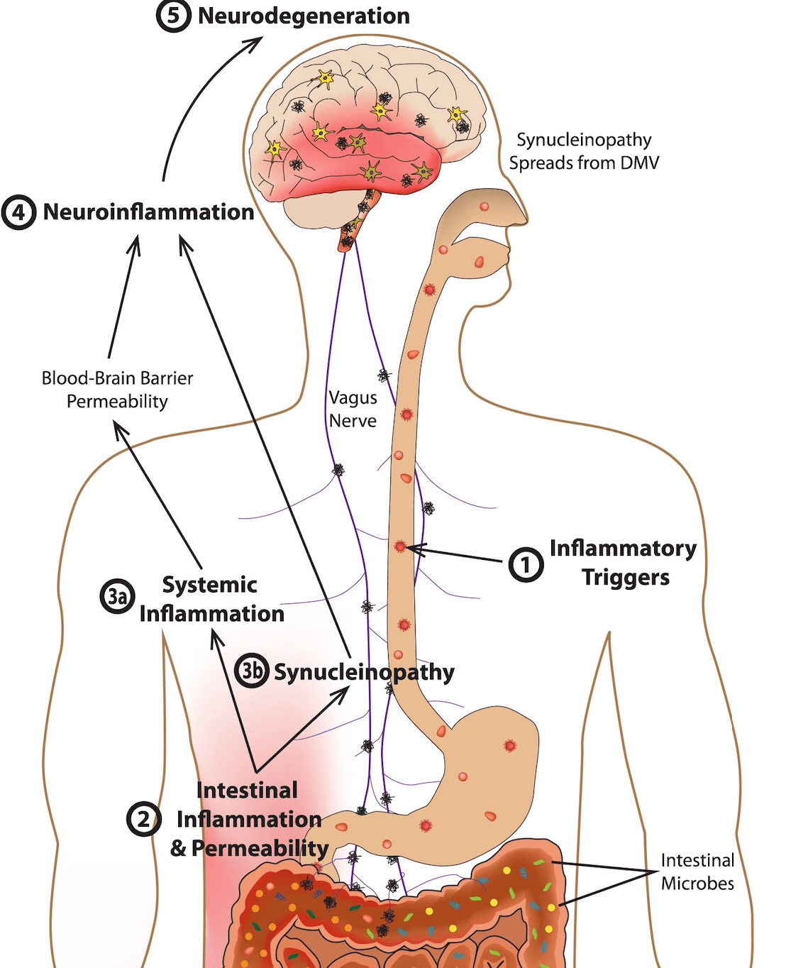 Tại sao stress lại gây đau bao tử?